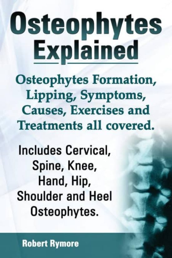 OSTEOPHYTES EXPLAINED OSTEOPHYTES FORMATION LIPPING SYMPTOMS CAUSES