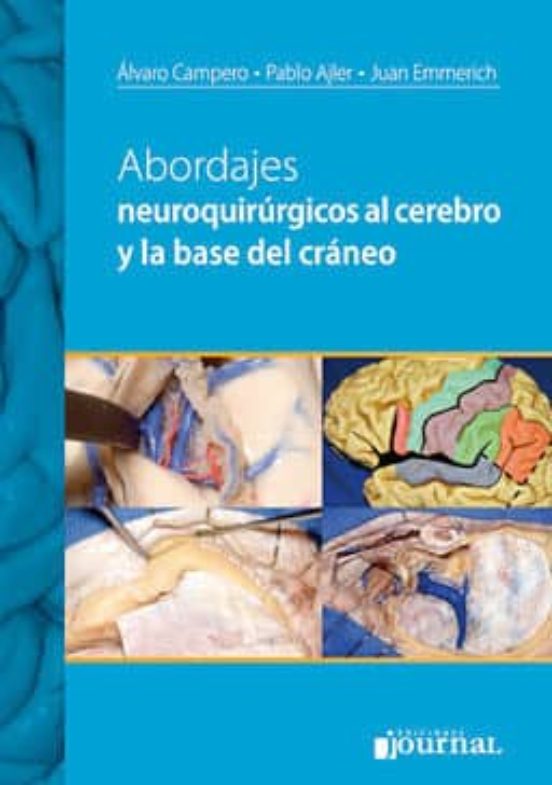 ABORDAJES NEUROQUIRURGICOS AL CEREBRO Y A LA BASE DEL CRANEO A