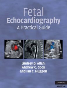 fetal echocardiography-9780521695206