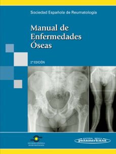 manual de enfermedades oseas (2ª ed.)-luis arboleya rodriguez-luis perez edo-9788498352306