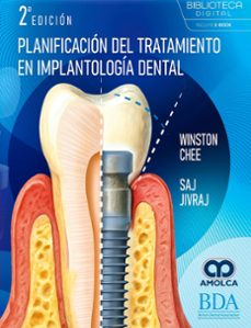 planificación del tratamiento en implantología dental-winston chee-saj jivraj-9789962748106