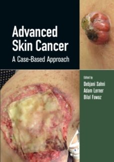 advanced skin cancer-adam lerner-9780367134716