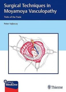 surgical techniques in moyamoya vasculopathy. tricks of the trade-9783131450616