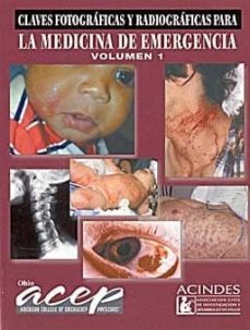 la medicina de emergencia (vol. 1) : claves fotograficas y radiog raficas-9789507622816