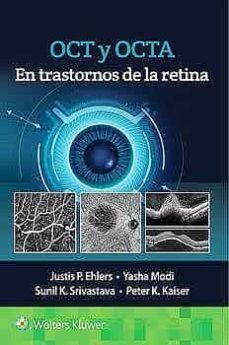 oct y octa en trastornos de la retina-9788418563126