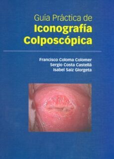 guia practica de iconografia colposcopica-francisco coloma colomer-sergio costa castella-isabel saiz giorgeta-9788484739326