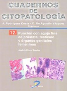 puncion con aguja fina de prostata, testiculo y organos genitales femeninos-andres perez barrios-9788499697826