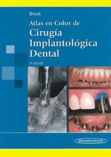 atlas en color de cirugia implantologica dental. 2ª ed.-9789500601726
