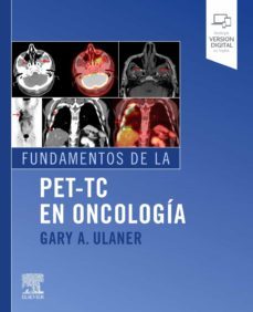 fundamentos de la pet-tc en oncologia-gary a. ulaner-9788491136736