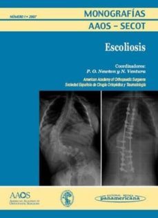 monografias aaos-secot nº 1 2007 : escoliosis-9788498351736