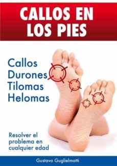 callos en los pies - solucion definitiva para callos, tilomas y helomas. (ebook)-9791222001036