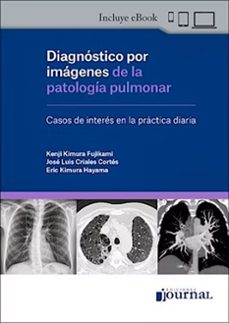 diagnostico por imagenes de la patologia pulmonar-kenji kimura fujikami-jose luis criales cortes-eric kimura hayama-9789878452746