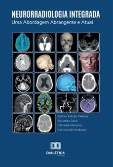 neurorradiologia integrada (ebook)-esther falcão feitosa-eduardo jucá-pâmela munhoz-9786527050056