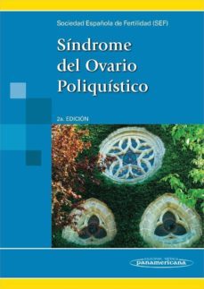 sindrome del ovario poliquistico 2ª ed.-9788498354256