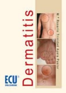 dermatitis (ebook)-mª rosario trinidad ayela pastor-9788499482156