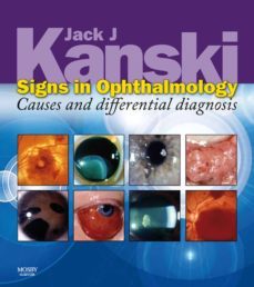 signs in ophthalmology: causes and differential diagnosis e-book (ebook)-jack j. kanski-9780723436966
