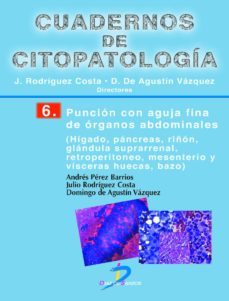 punción con aguja fina de órganos abdominales (ebook)-j. rodriguez de castro-9788490520666