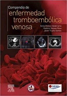 compendio de enfermedad tromboembolica venosa-s. otalora-9788491137276
