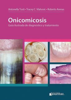 onicomicosis-roberto arenas-9789874922076