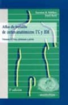atlas de bolsillo de cortes anatomicos. tcirm (vol. 2): torax, ab domen y pelvis (2ª ed.)-9788479035686