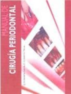 manual de cirugia periodontal-juan jose echeverria garcia-9788484736486