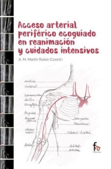 acceso arterial periferico ecoguiado en reanimacion y cuidados intensivos-antonio m. martin rubio-9788490888186