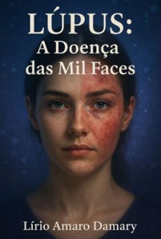 lupus: a doença das mil faces (ebook)-lírio amaro damary-3410008977896