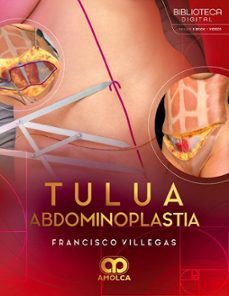 tulua abdominoplastia-francisco villegas-9786287785496