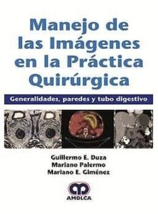 Descargas gratuitas de archivos de libros electrónicos MANEJO DE LAS IMAGENES EN LA PRACTICA QUIRURGICA. GENERALIDADES, PAREDES Y TUBO DIGESTIVO FB2 ePub de G. - PALERMO, M. - GIMÉNEZ, M. DUZA in Spanish 9789585426306