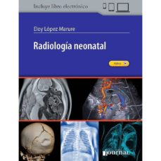 Descargar google ebooks nook RADIOLOGÍA NEONATAL in Spanish de E. LÓPEZ-MARURE