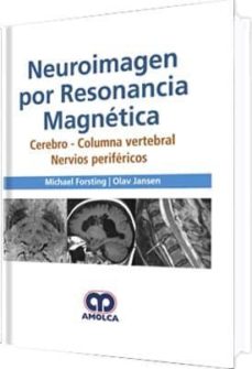 Descarga gratuita de libros en pdf en inglés. NEUROIMAGEN POR RESONANCIA MAGNETICA: CEREBRO, COLUMNA VERTEBRAL, NERVIOS PERIFERICOS de M. & FORSTING