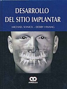 Descarga gratuita de texto de libros electrónicos DESARROLLO DEL SITIO IMPLANTAR (Spanish Edition) de MICHAEL SONICK CHM iBook