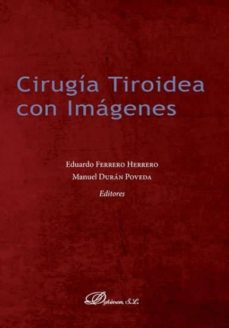 Libros gratis para descargar en ipad 3 CIRUGIA TIROIDEA CON IMAGENES (Spanish Edition) 9788491481546 PDF de EDUARDO FERRERO HERRERO