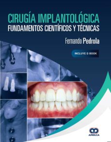 Ebooks descarga pdf gratis CIRUGÍA IMPLANTOLÓGICA. FUNDAMENTOS CIENTÍFICOS Y TÉCNICAS de F. PEDROLA PDF MOBI