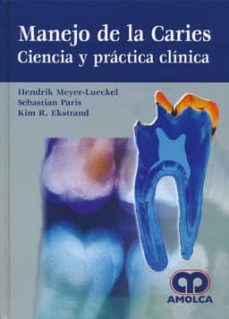 Descargar torrent de libros electronicos MANEJO DE LA CARIES: CIENCIA Y PRACTICA CLINICA de HENDRIK MEYER-LUECKEL, SEBASTIAN PARIS in Spanish